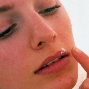 Профилактика герпеса на губах